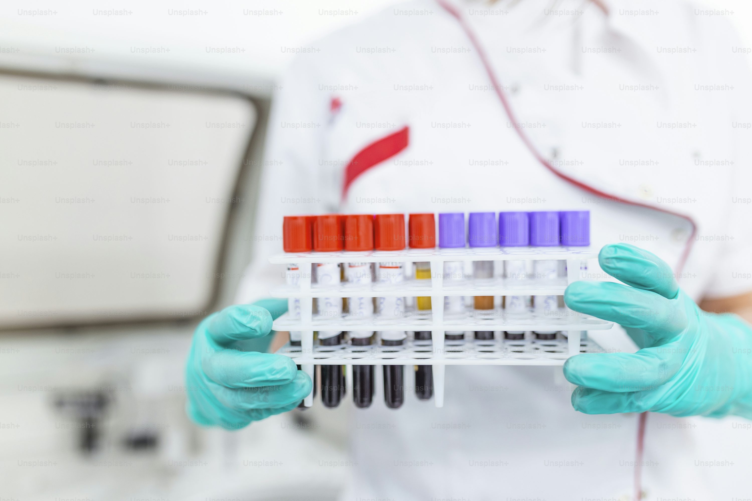 Laboratory Test